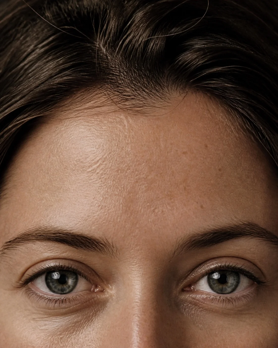 Forehead and eye area at rest under flat frontal light.